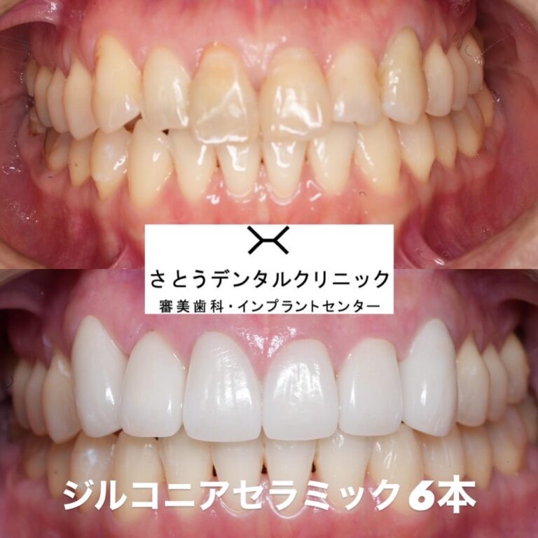 審美歯科