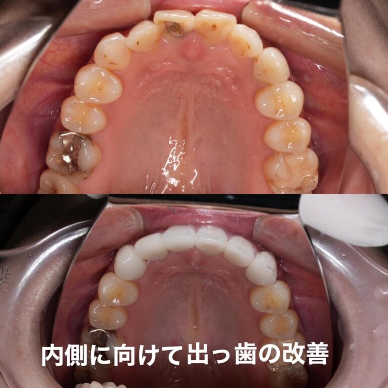 審美歯科