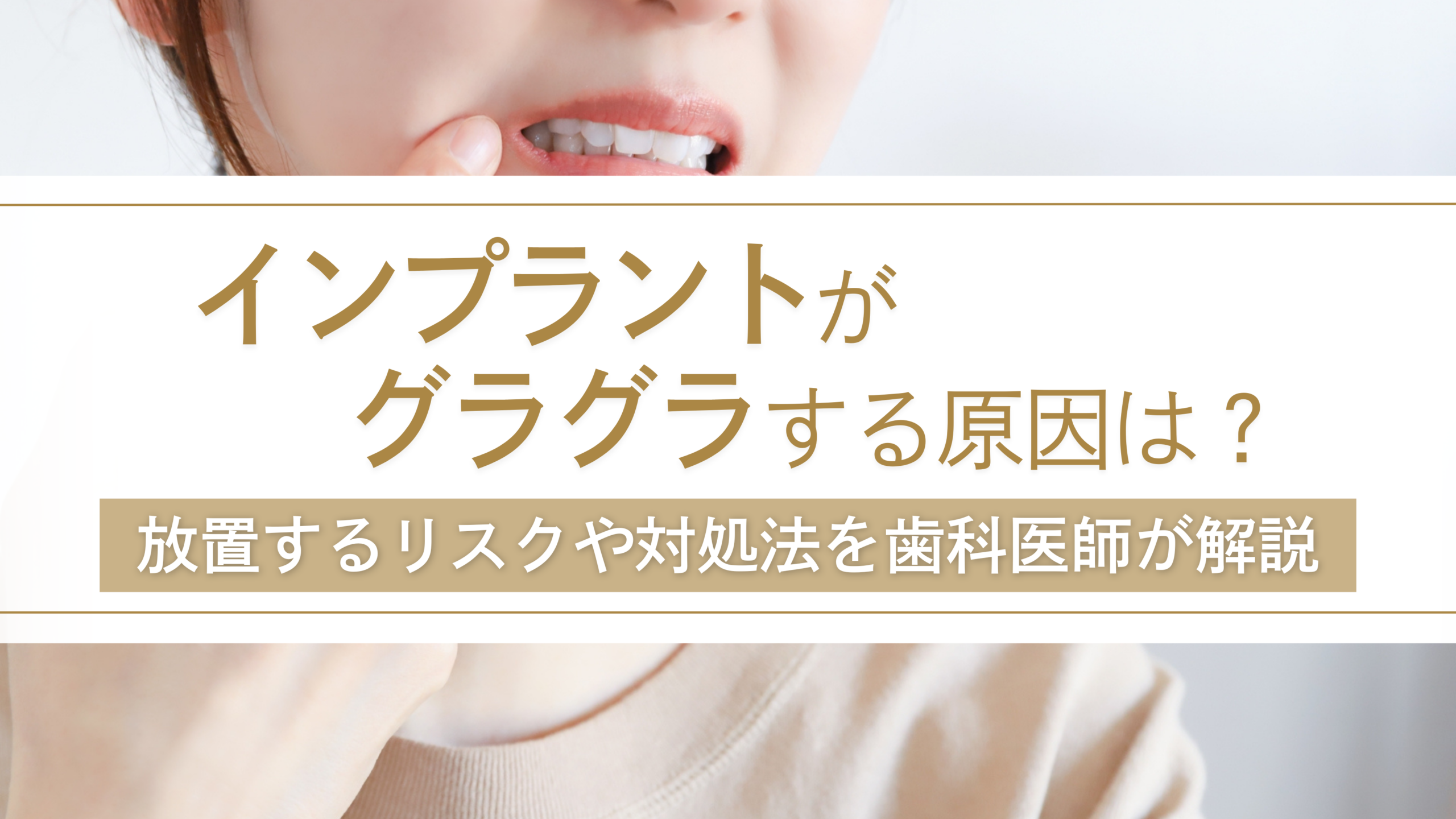 インプラントがグラグラする原因は？放置するリスクや対処法を歯科医師が解説