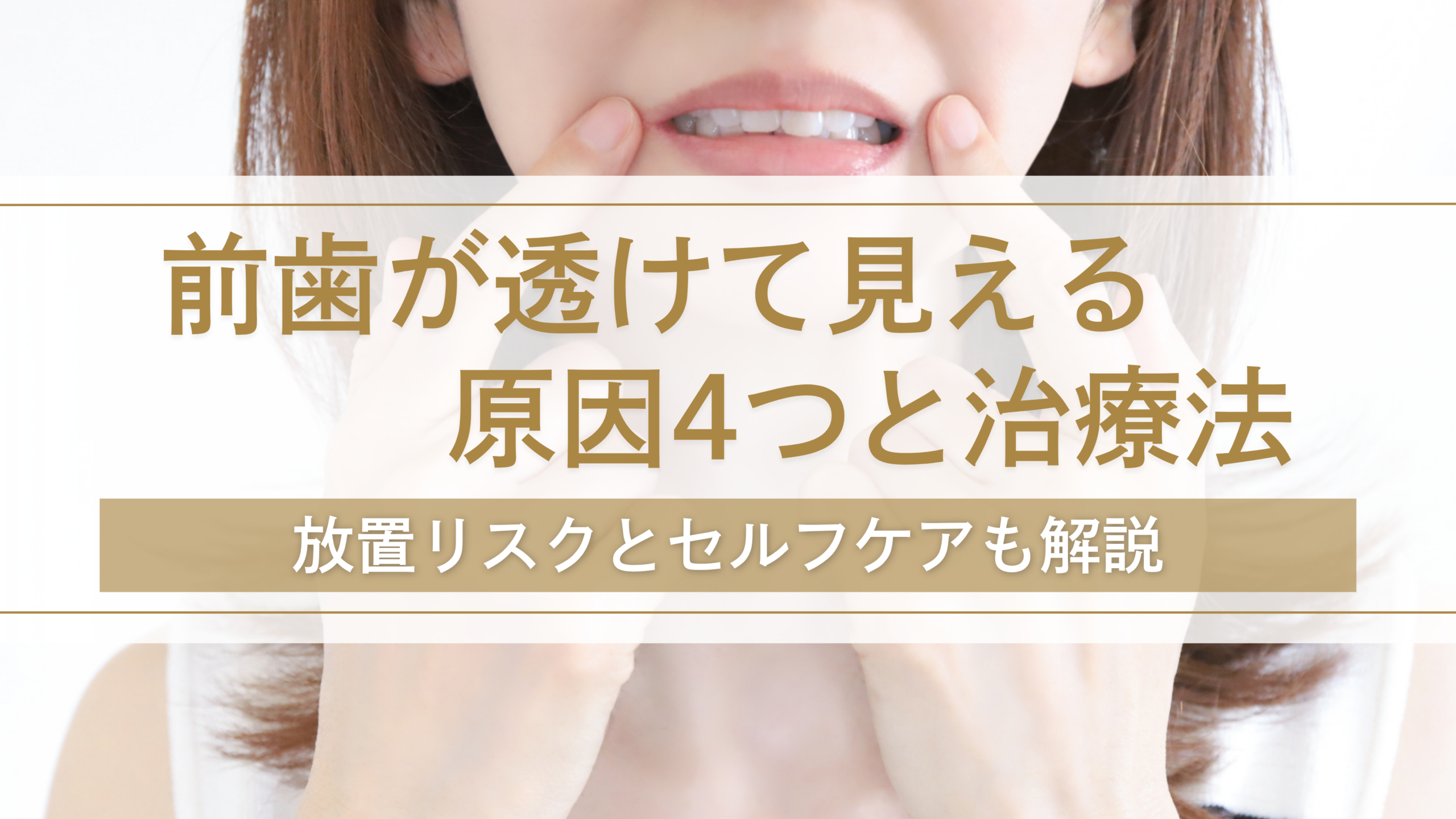 前歯が透けて見える原因4つと治療法｜放置リスクとセルフケアも解説